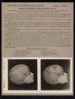Cranio-Cerebral Topography - no. 6